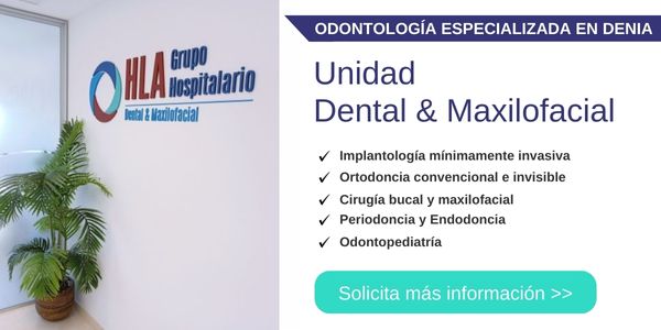 Servicios dentales en Denia