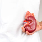 Litiasis urinaria, conocida como piedras en el riñón
